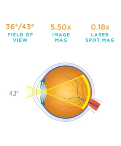 Офтальмологічна лінза Macula Plus