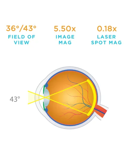 Офтальмологічна лінза Macula Plus