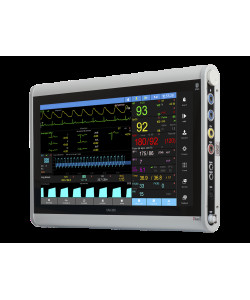 Монітор пацієнта UM 300-20-S