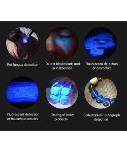 Лампа Вуда професійна LED YOUWEMED BZ-300