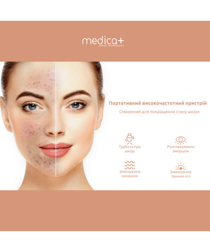 Портативна дарсонваль MEDICA+ DARSOLINE 4.0